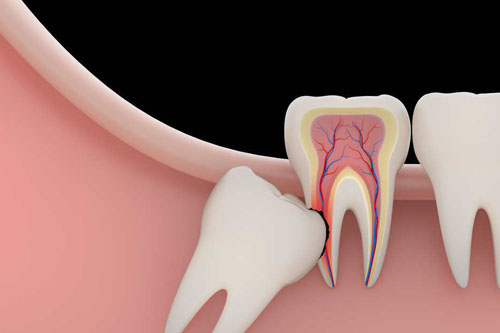 Cirugía Maxilofacial